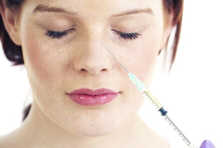 Rinoplastia non cirúrxica con recheos