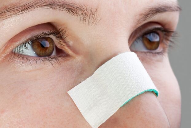 posibles complicacións no período postoperatorio de corrección do tabique nasal